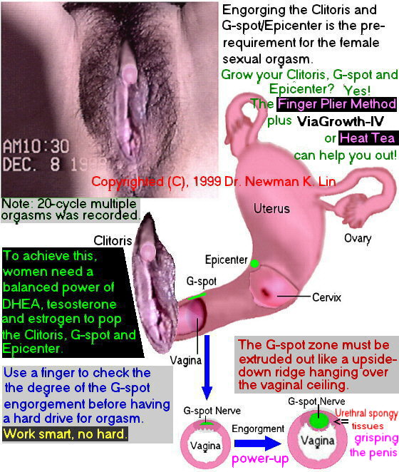 Orgasm Hysterectomy 88